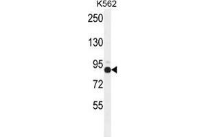 ZNF366 Antibody (C-term) western blot analysis in K562 cell line lysates (35 µg/lane). (ZNF366 抗体  (C-Term))