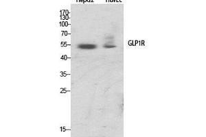 Western Blot (WB) analysis of specific cells using GLP-1R Polyclonal Antibody. (GLP1R 抗体  (Internal Region))