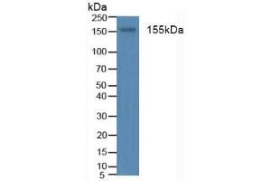 Detection of INSR in Human Blood Cells using Polyclonal Antibody to Insulin Receptor (INSR) (Insulin Receptor 抗体  (AA 1024-1298))