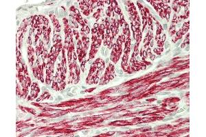 Uterus Myometrium (Desmin 抗体)