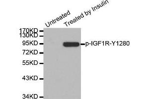Western blot analysis of extract from 293 cells, using Phospho-IGF1R-Y1280 antibody. (IGF1R 抗体  (pTyr1280))