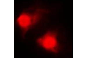 Immunofluorescent analysis of RAR beta staining in MDAMB435 cells. (Retinoic Acid Receptor beta 抗体  (C-Term))