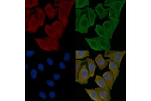 ABIN6265987 and ABIN6276890 staining Hela cells(30 min of UV treatment) by IF/ICC. (Vip 抗体  (Internal Region))