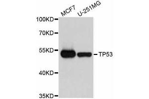 Western blot analysis of extracts of various cell lines, using TP53 antibody. (p53 抗体  (AA 1-110))