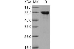 Western Blotting (WB) image for Serine/threonine-Protein Kinase MST4 (MST4) (Active) protein (GST tag) (ABIN7317098) (STK26/MST4 Protein (GST tag))