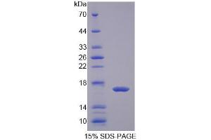 SDS-PAGE analysis of Cow FABP2 Protein. (FABP2 蛋白)