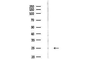 Western blot analysis of lysates from HepG2 cells(heat-shock,45 min treatment), using RA Antibody at 1/1000 dilution.