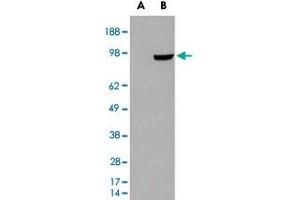HEK293 overexpressing PDE5A and probed with PDE5A polyclonal antibody  (mock transfection in first lane), tested by Origene. (PDE5A 抗体)