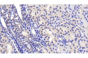 Detection of SPTAN1 in Human Kidney Tissue using Polyclonal Antibody to Alpha-Fodrin (SPTAN1) (SPTAN1 抗体  (AA 1573-1742))