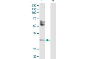 Western Blot analysis of TREX1 expression in transfected 293T cell line by TREX1 MaxPab polyclonal antibody. (TREX1 抗体  (AA 1-304))