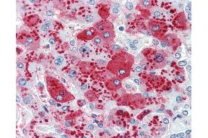 Anti-CDCP1 antibody IHC of human liver. (CDCP1 抗体  (Internal Region))