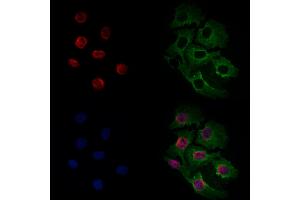 ABIN6261598 and ABIN6266535 staining Hela cells by IF/ICC.