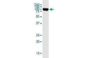 OPA1 monoclonal antibody (M02), clone 8A20. (OPA1 抗体  (AA 851-960))