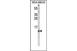 Western blot analysis of Hepcidin / HAMP Antibody (Center) in MDA-MB435 cell line lysates (35ug/lane). (Hepcidin 抗体  (Middle Region))