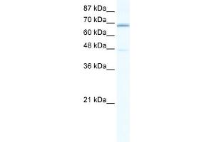 WB Suggested Anti-CACNB2 Antibody Titration:  0. (CACNB2 抗体  (C-Term))