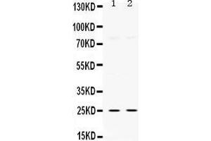 Western Blotting (WB) image for anti-Thymidine Kinase 1, Soluble (TK1) (AA 2-234) antibody (ABIN3042478) (TK1 抗体  (AA 2-234))