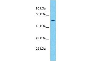 Host:  Rabbit  Target Name:  PAX7  Sample Type:  Fetal heart lysates  Antibody Dilution:  1. (PAX7 抗体  (C-Term))