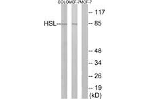 Western blot analysis of extracts from COLO/MCF7 cells, using HSL (Ab-552) Antibody. (LIPE 抗体  (AA 518-567))