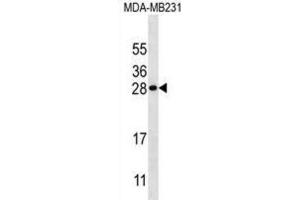 Western Blotting (WB) image for anti-Kallikrein 7 (KLK7) antibody (ABIN3002617)