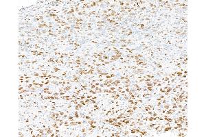 Immunohistochemistry (IHC) image for anti-Promyelocytic Leukemia (PML) (AA 375-425) antibody (ABIN7454722)