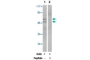 Western blot analysis of extracts from K-562 cells treated with H 2 O 2  (100 uM, 30 mins), using LYN polyclonal antibody . (CD180 抗体)