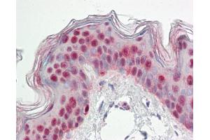 Image no. 1 for anti-Nuclear Factor of Activated T-Cells 5, Tonicity-Responsive (NFAT5) (AA 41-298) antibody (ABIN467533)