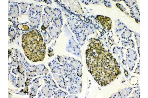 IHC analysis of HSPB8/Hsp22 using anti- HSPB8/Hsp22 antibody . (HSPB8 抗体  (AA 1-196))