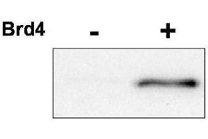Western blot using  affinity purified anti-CDK9 pT29 antibody shows detection of phosphorylated CDK9.