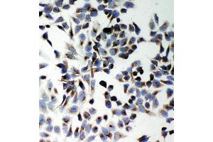 Anti-SQSTM1/p62 antibody, ICC ICC: Hela Cell (SQSTM1 抗体  (N-Term))