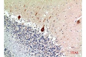 Immunohistochemical analysis of paraffin-embedded human-brain, antibody was diluted at 1:100 (Nodal 抗体  (C-Term))