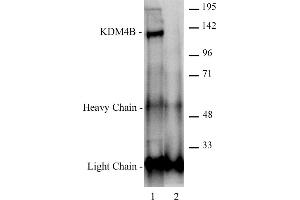 JMJD2B / KDM4B antibody (pAb) tested by Immunoprecipitation. (KDM4B 抗体  (C-Term))