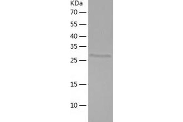 POU2AF1 Protein (AA 1-256) (His tag)
