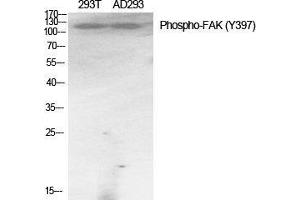 Western Blot (WB) analysis of specific cells using Phospho-FAK (Y397) Polyclonal Antibody. (FAK 抗体  (pTyr397))