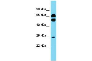 Host: Rabbit Target Name: CD200R1L Sample Type: Fetal Heart lysates Antibody Dilution: 1. (CD200R1L 抗体  (N-Term))