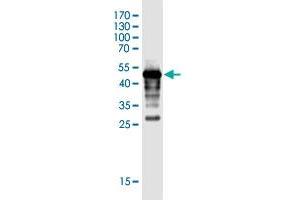 Western Blot detection against Immunogen (44. (FLJ35767 (AA 1-164) 抗体)