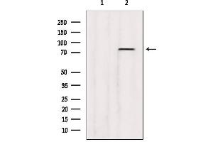 Western blot analysis of extracts from B16F10, using ABCD3 Antibody. (CX3CL1 抗体  (C-Term))