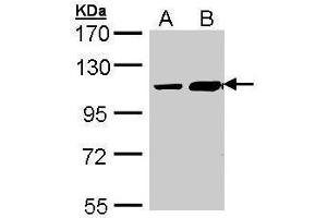 TRAK2 抗体  (C-Term)