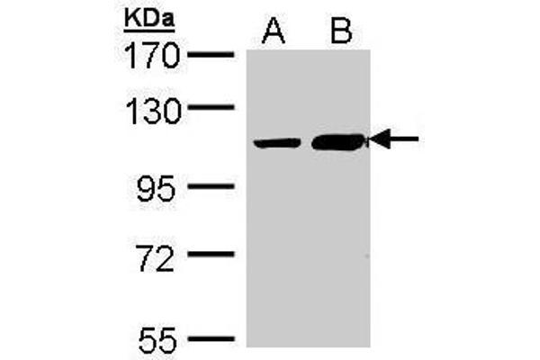 TRAK2 抗体  (C-Term)