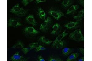 Immunofluorescence analysis of U-2 OS cells using Polyclonal AntibodyPC1 Polyclonal Antibody at dilution of 1:100 (40x lens). (PC1 抗体)
