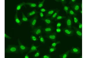 Immunofluorescence analysis of A549 cells using APTX antibody (ABIN5973100). (Aprataxin 抗体)