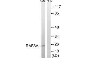 Western blot analysis of extracts from A549 cells, using RAB6A antibody. (RAB6A 抗体  (Internal Region))