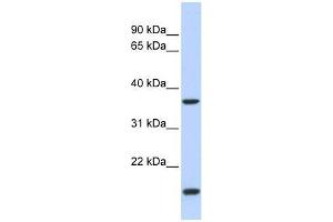 ZIC4 antibody used at 0. (ZIC4 抗体  (N-Term))