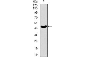 Western Blotting (WB) image for anti-ATP-Binding Cassette, Sub-Family B (MDR/TAP), Member 5 (ABCB5) (AA 481-674) antibody (ABIN1842667)