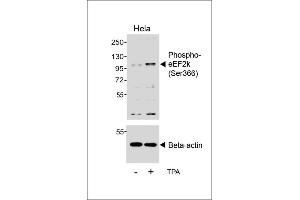 Western blot analysis of lysates from Hela cell line, untreated or treated with T, 200nM, using (ABIN6241062 and ABIN6578958) (upper) or Beta-actin (lower). (EEF2K 抗体  (pSer366))