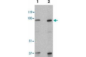 Western blot analysis of SKI in human kidney tissue lysate with SKI polyclonal antibody  at 1 and 2 ug/mL . (SKI 抗体  (N-Term))