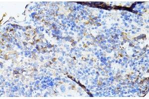 Immunohistochemistry of paraffin-embedded Mouse spleen using TEFM Polyclonal Antibody at dilution of 1:100 (40x lens). (TEFM 抗体)