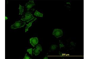 Immunofluorescence of monoclonal antibody to LEPRE1 on HeLa cell. (LEPRE1 抗体  (AA 1-100))