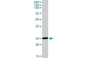 MSRA MaxPab rabbit polyclonal antibody. (MSRA 抗体  (AA 1-235))