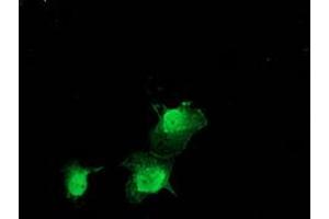 Anti-ZFAND2B mouse monoclonal antibody (ABIN2454250) immunofluorescent staining of COS7 cells transiently transfected by pCMV6-ENTRY ZFAND2B (RC203822). (ZFAND2B 抗体)