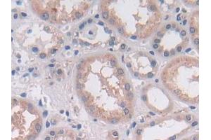 DAB staining on IHC-P; Samples: Human Kidney Tissue (OAS2 抗体  (AA 11-346))